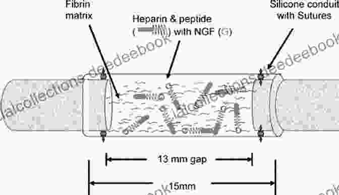 Nerve Guidance Conduit Implantation Modern Concepts Of Peripheral Nerve Repair