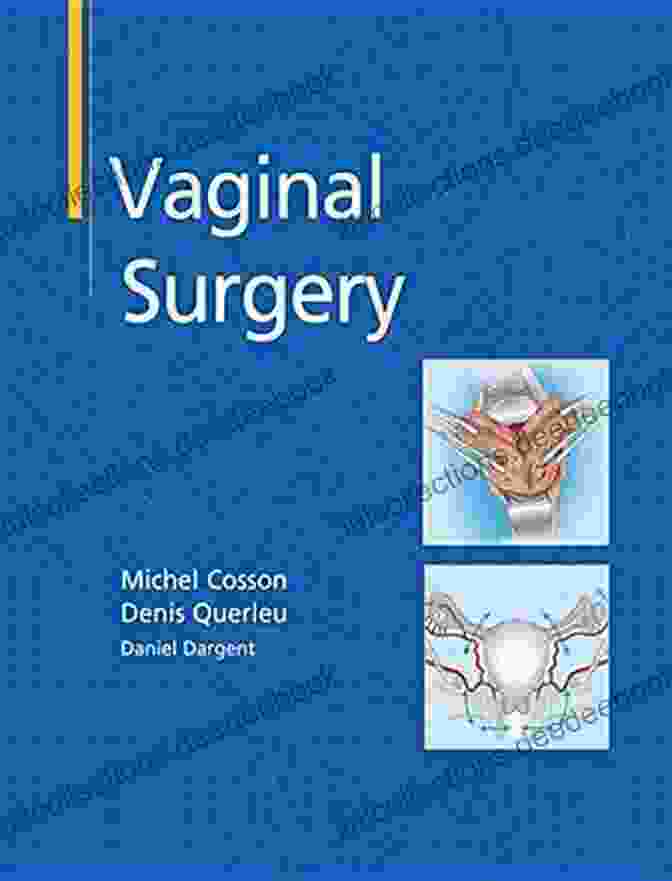 Vaginal Surgery By Dr. Michel Cosson Vaginal Surgery Michel Cosson