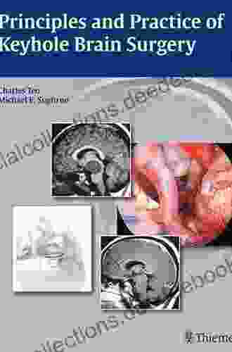 Principles And Practice Of Keyhole Brain Surgery